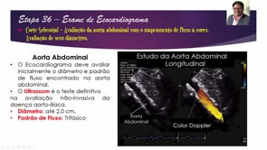 Eco De Excelência – Ep. 36 – Estudo Da Aorta Abdominal