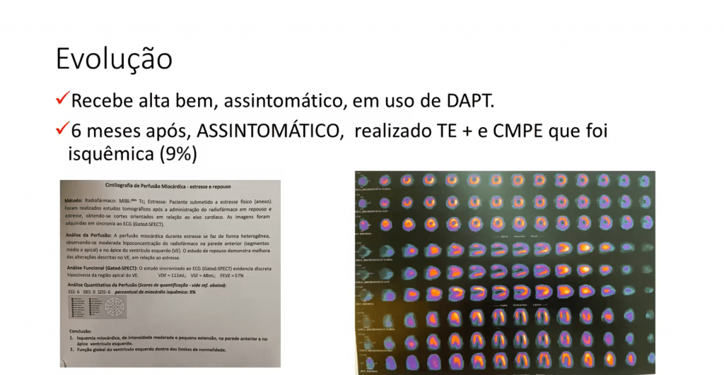 Caso Clínico De Dissecção
