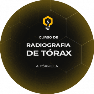 Assets-ATTAssets---Avatar raiox torax