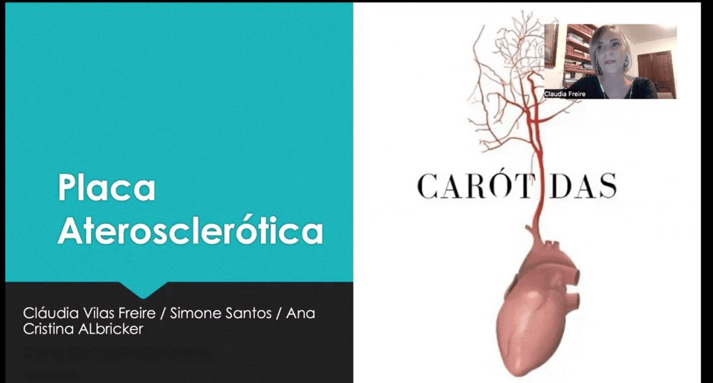 Carotidas Online Vascular