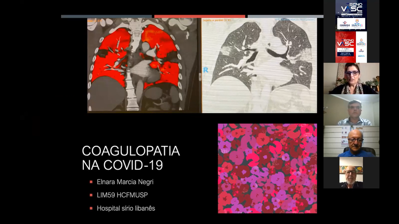 Coagulopatia Na Covid-19