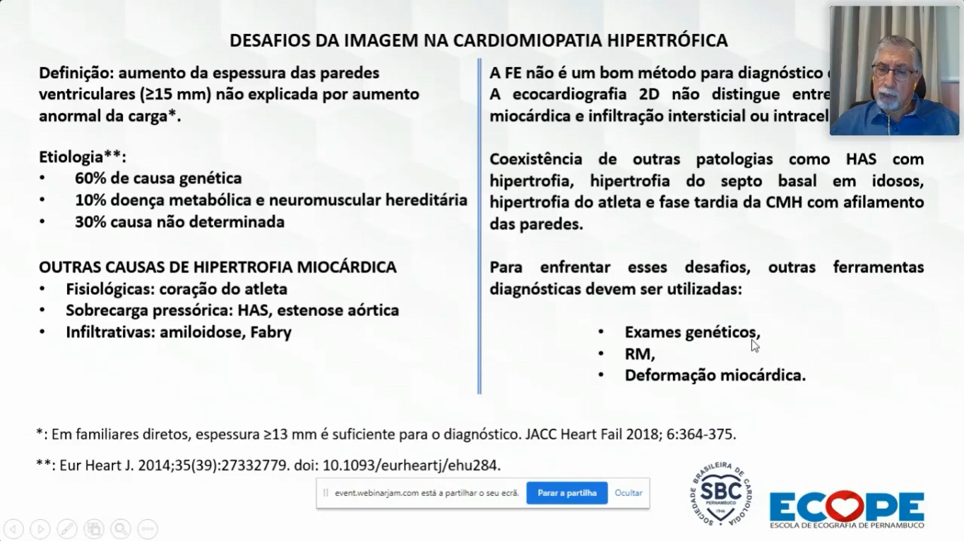 Diagnóstico Diferencial Em Hipertrofia Miocárdica: Novas Técnicas Da Ecocardiografia