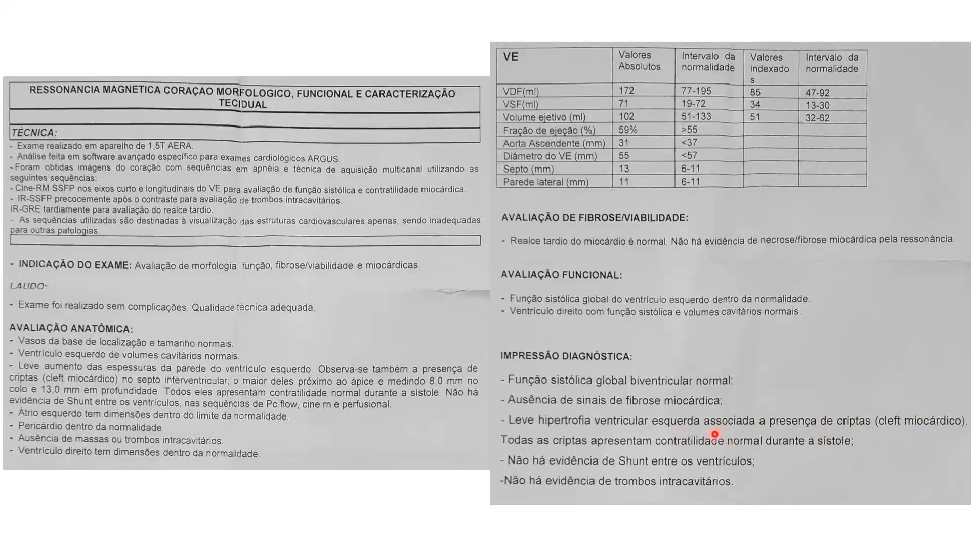 [DEPECO] Caso Clínico: Criptas - Cleft Miocárdio | makadu.live - 2023