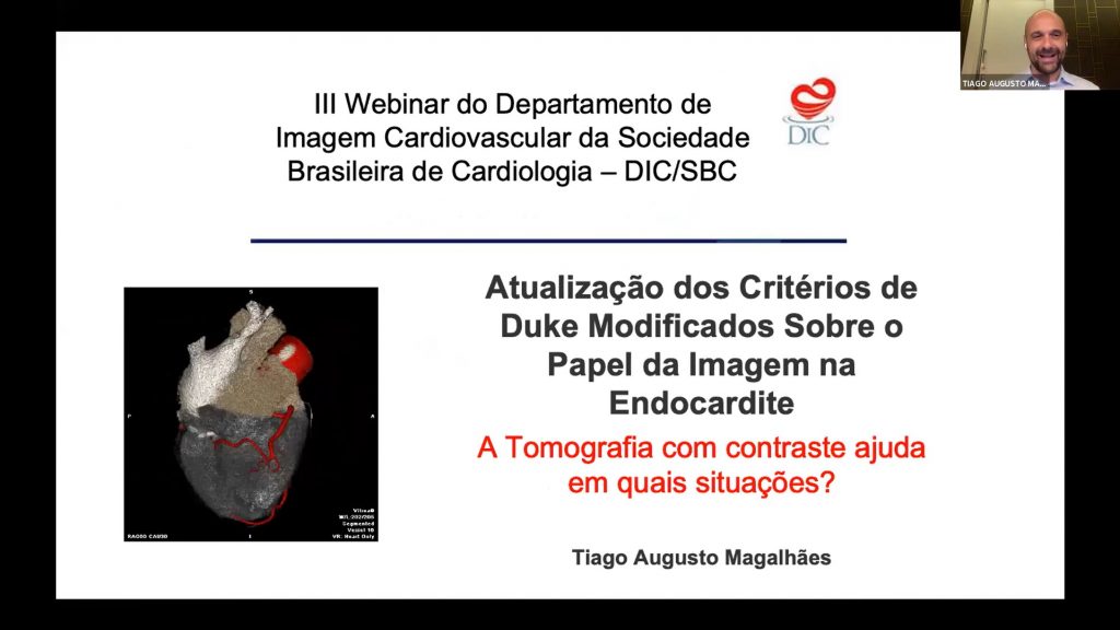 A Tomografia Com Contraste Ajuda Em Quais Situacoes Tiago Augusto Magalhaes
