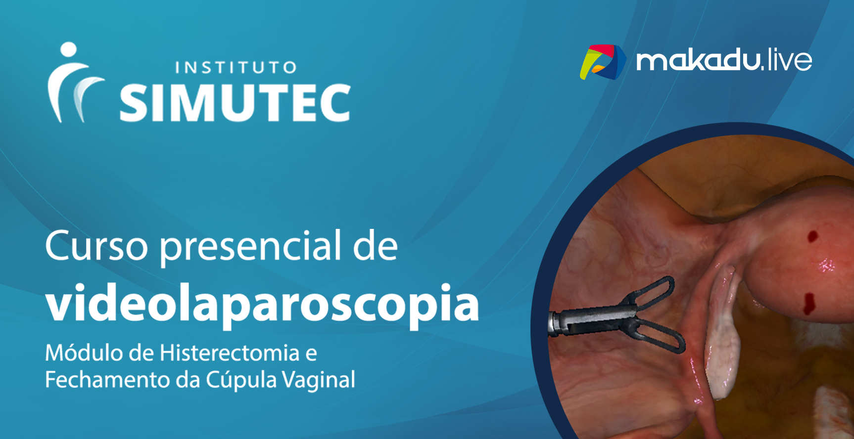 Módulo-De-Histerectomia-E-Fechamento-Da-Cúpula-Vaginal-Banner
