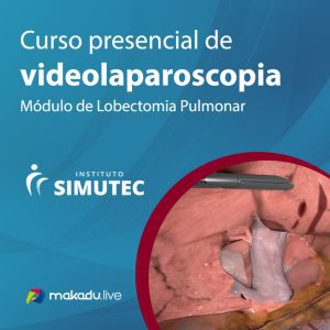 Modulo De Lobectomia Pulmonar Thumb