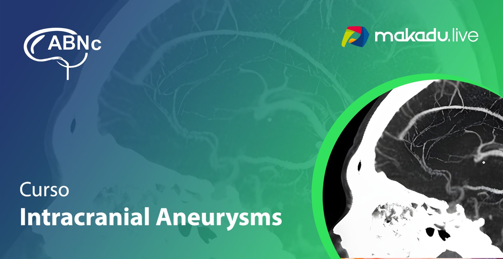 Assets-ABNc---Curso-Intracranial-Aneurysms-Banner