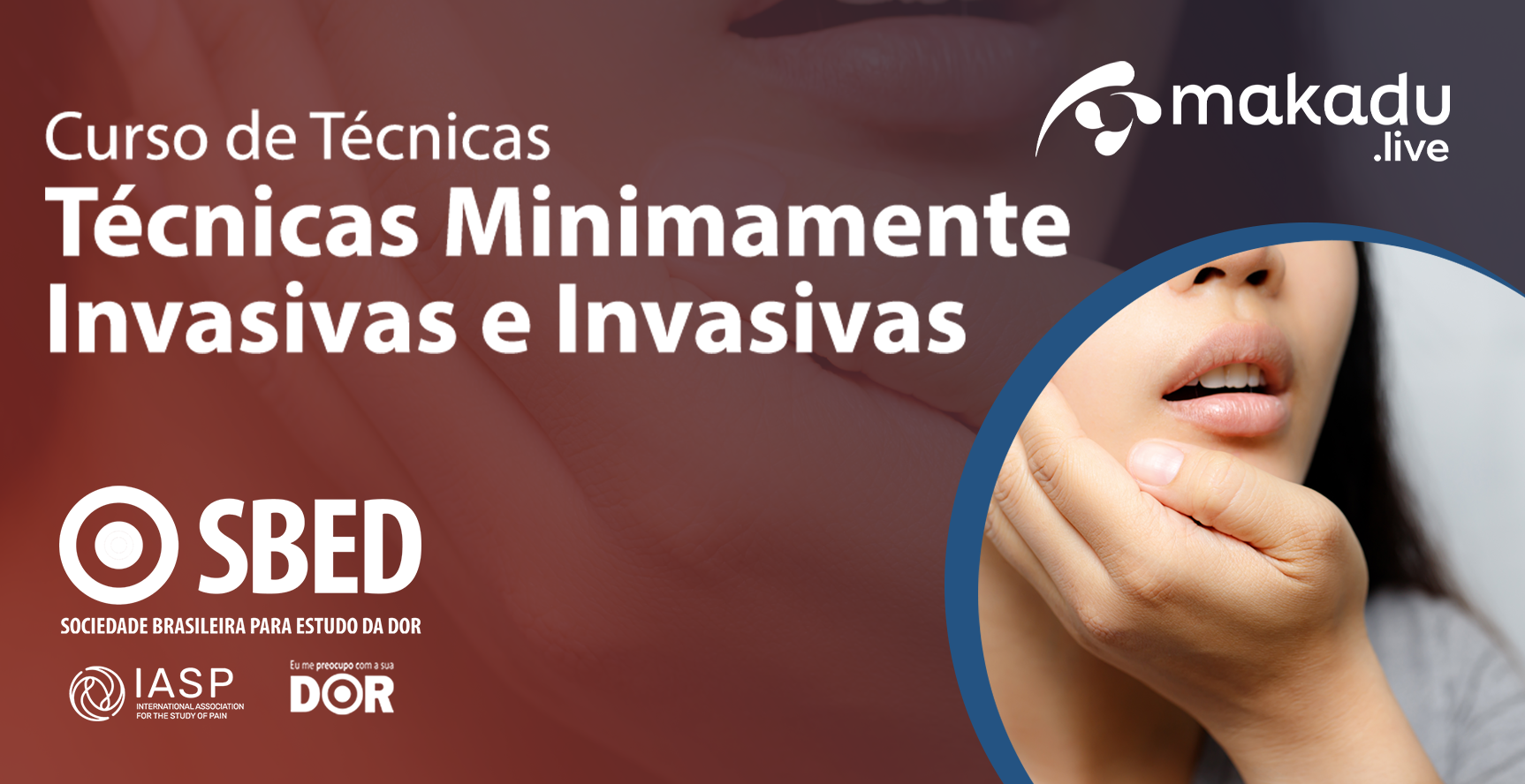 [PREMIUM] SBED - Curso de Técnicas Minimamente Invasivas | makadu.live