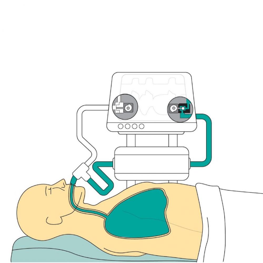 Curso De Assincronias Ventilatórias