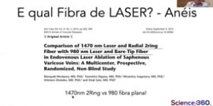 Laser para Safenas: Detalhes Técnicos e caminhos futuros